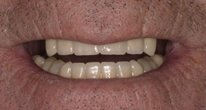 Cosmetic Dentists Santa Fe NM
