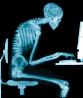 Skeleton of a person with poor posture