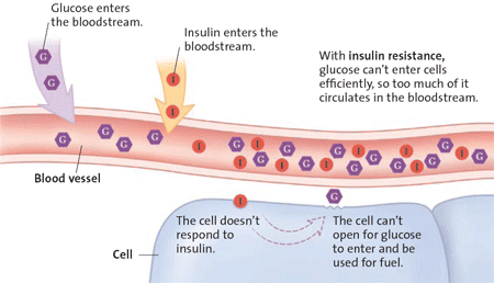 Diagram of diabetes