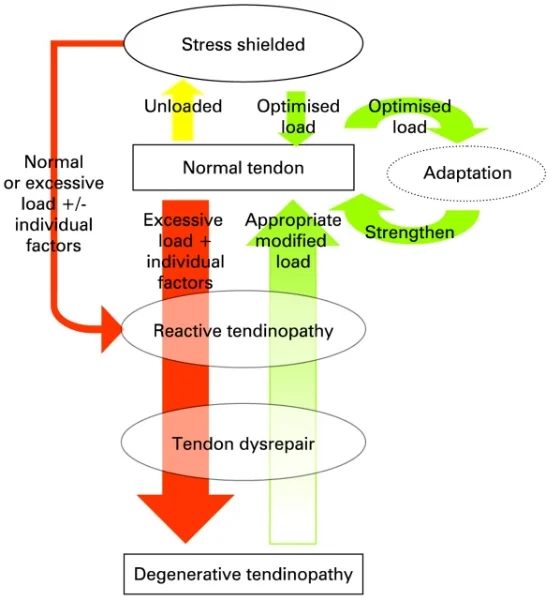 Tendonopathy flow chart.