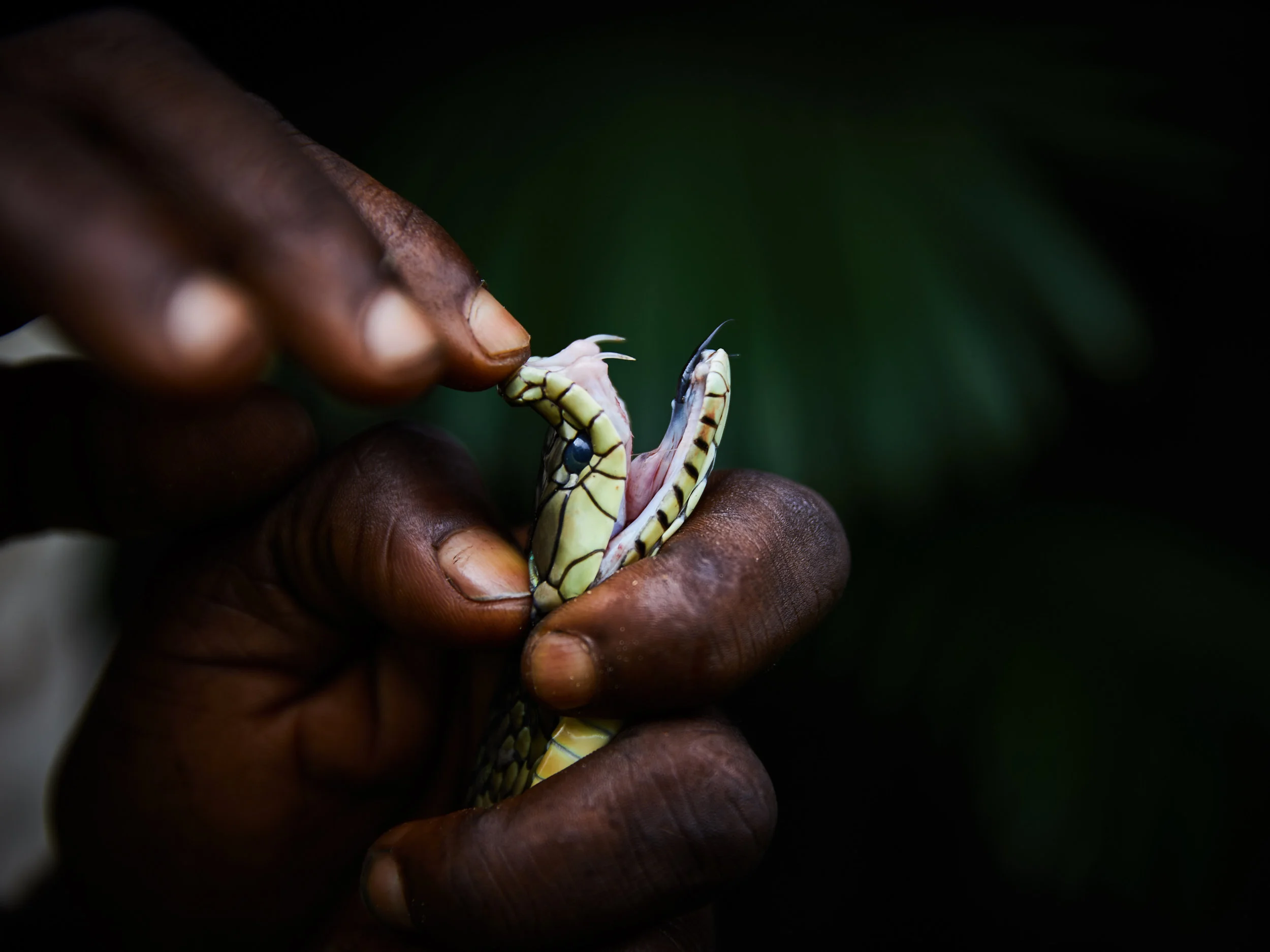 Snakebite Envenomation: A Global Health Crisis.