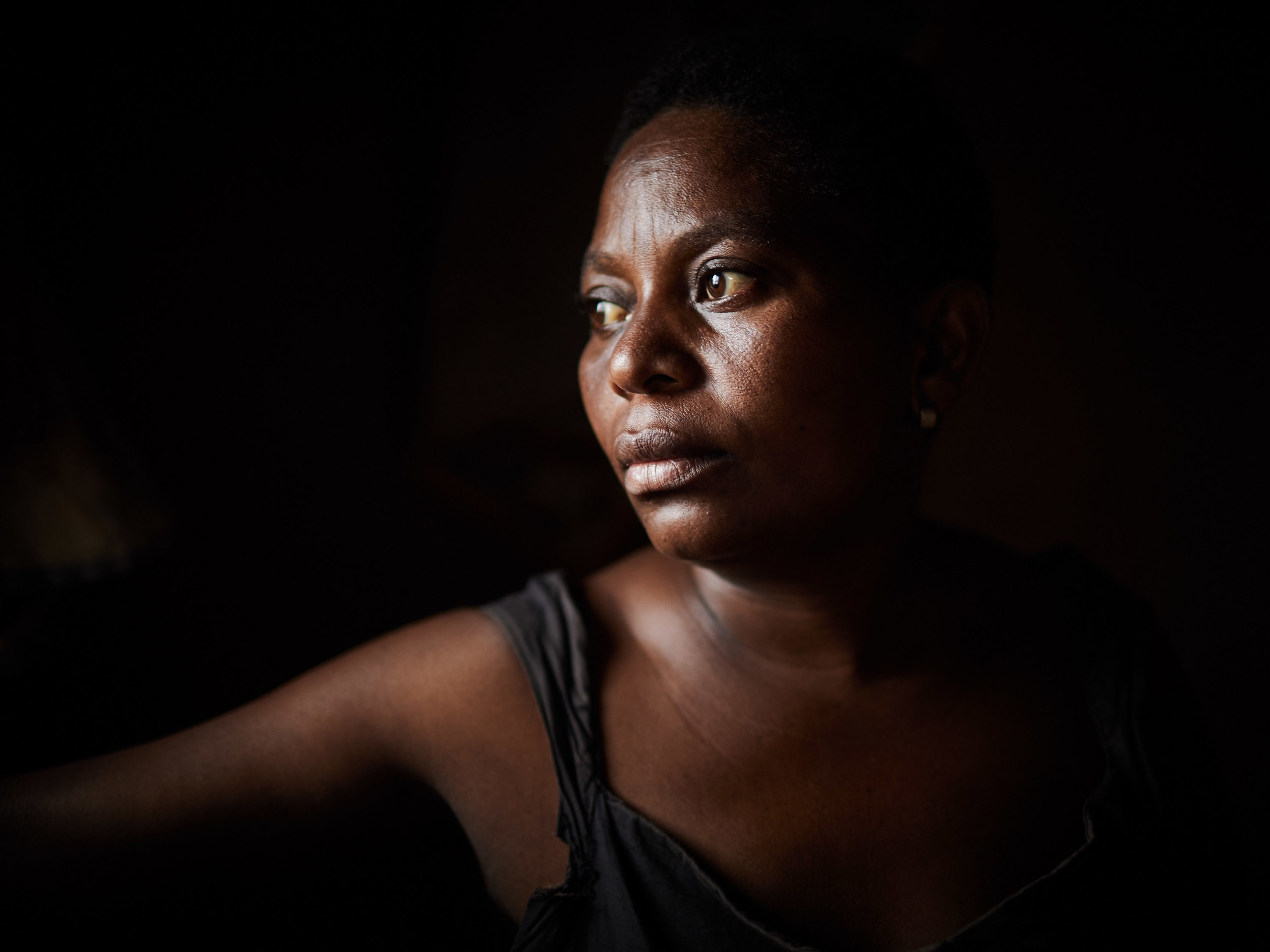  Jeanine Kibwana, an Ebola survivor, Beni, North Kivu. 