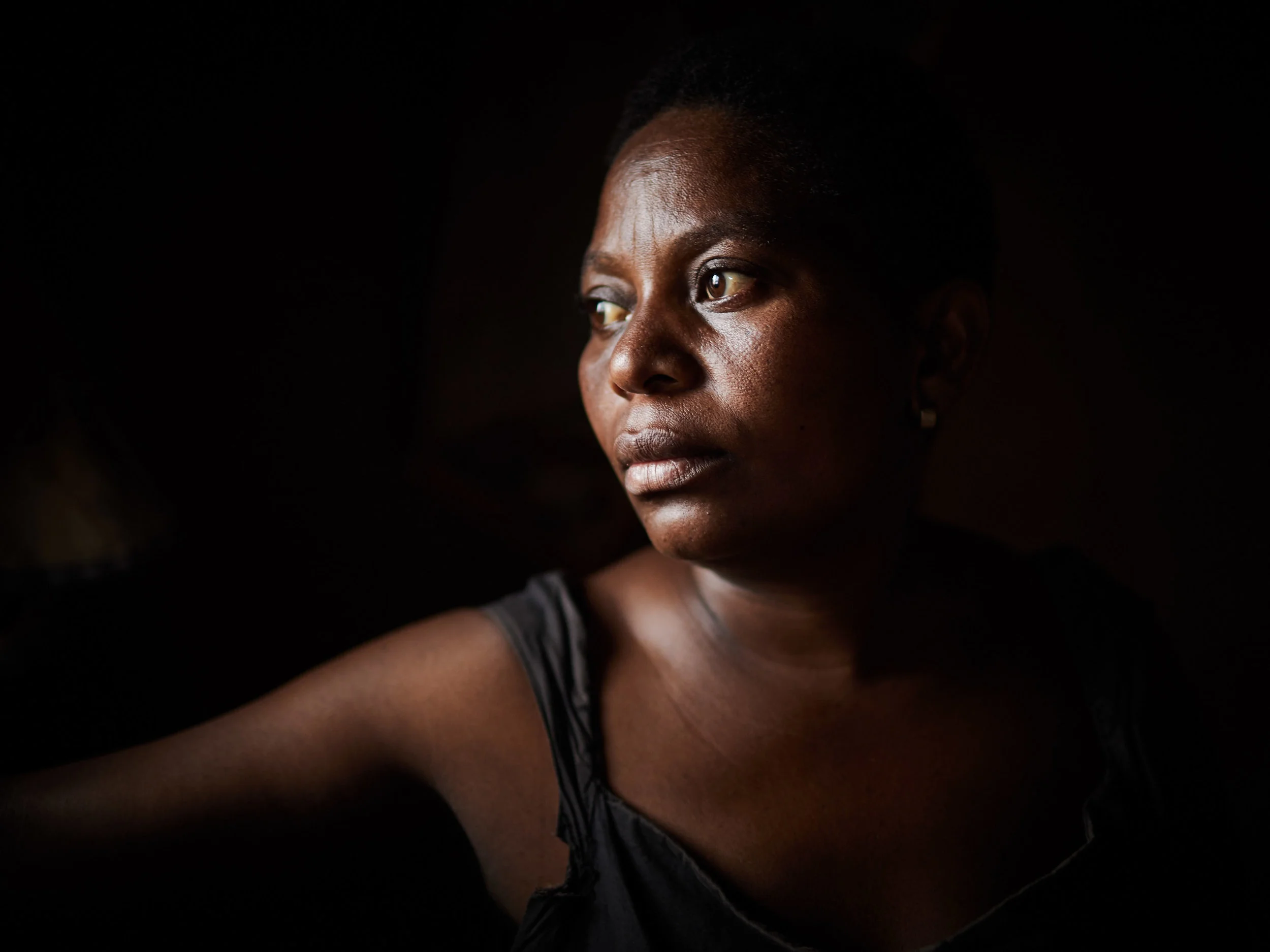 Jeanine Kibwana, an Ebola survivor, Beni, North Kivu.