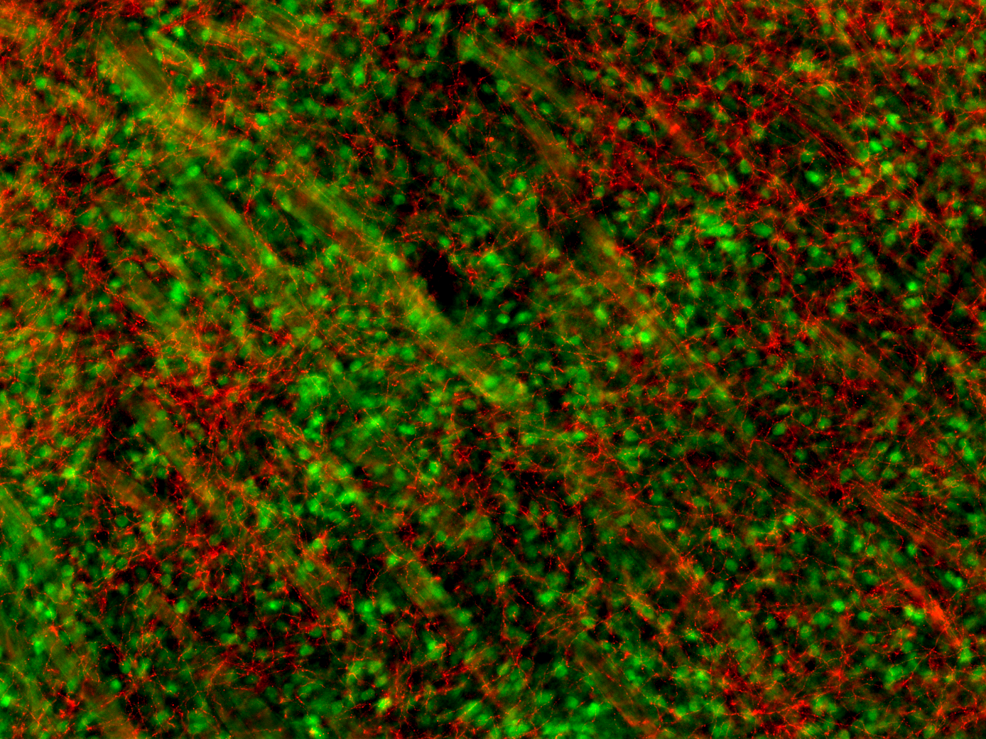 Serotonergic innerv in striat and D2 BAC GFP.png