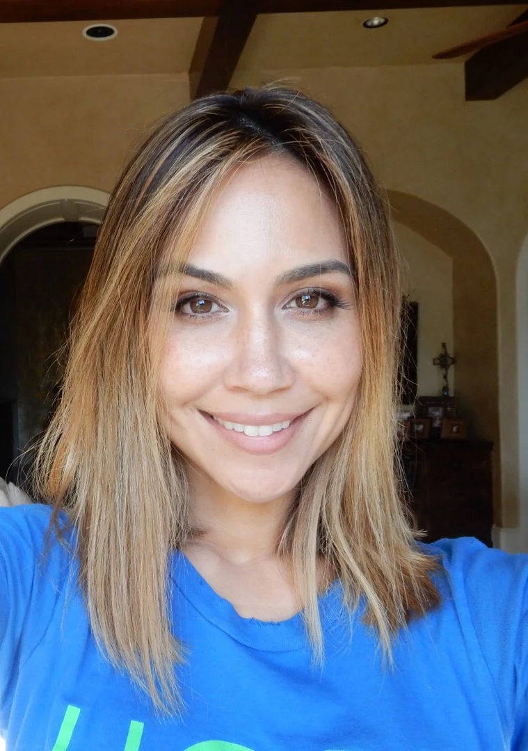 Before my Veneers!