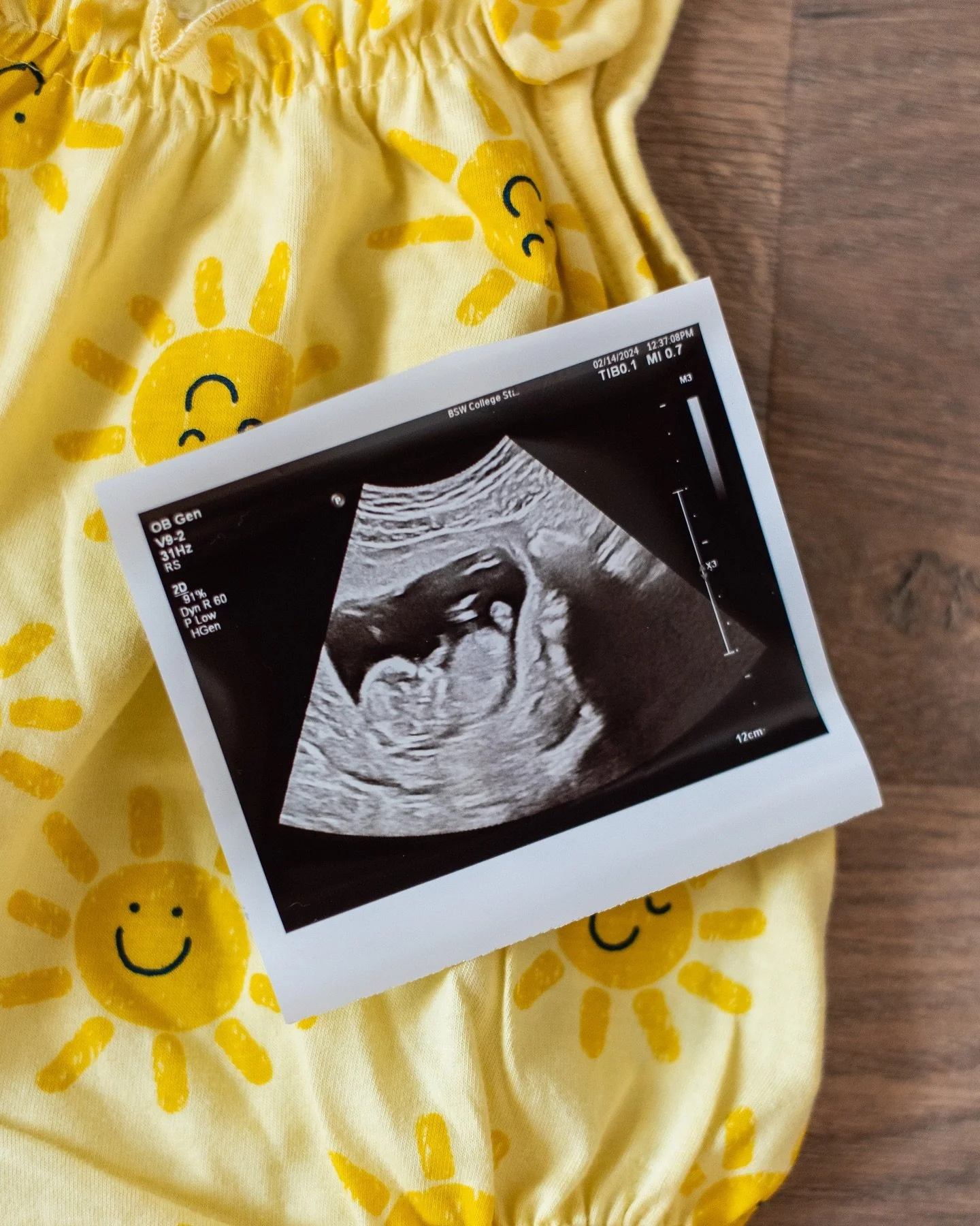 It&rsquo;s been quiet over here lately because I haven&rsquo;t been feeling the best, but we are so excited because our little sweetheart is on the way! Baby girl coming August 2024 🤍