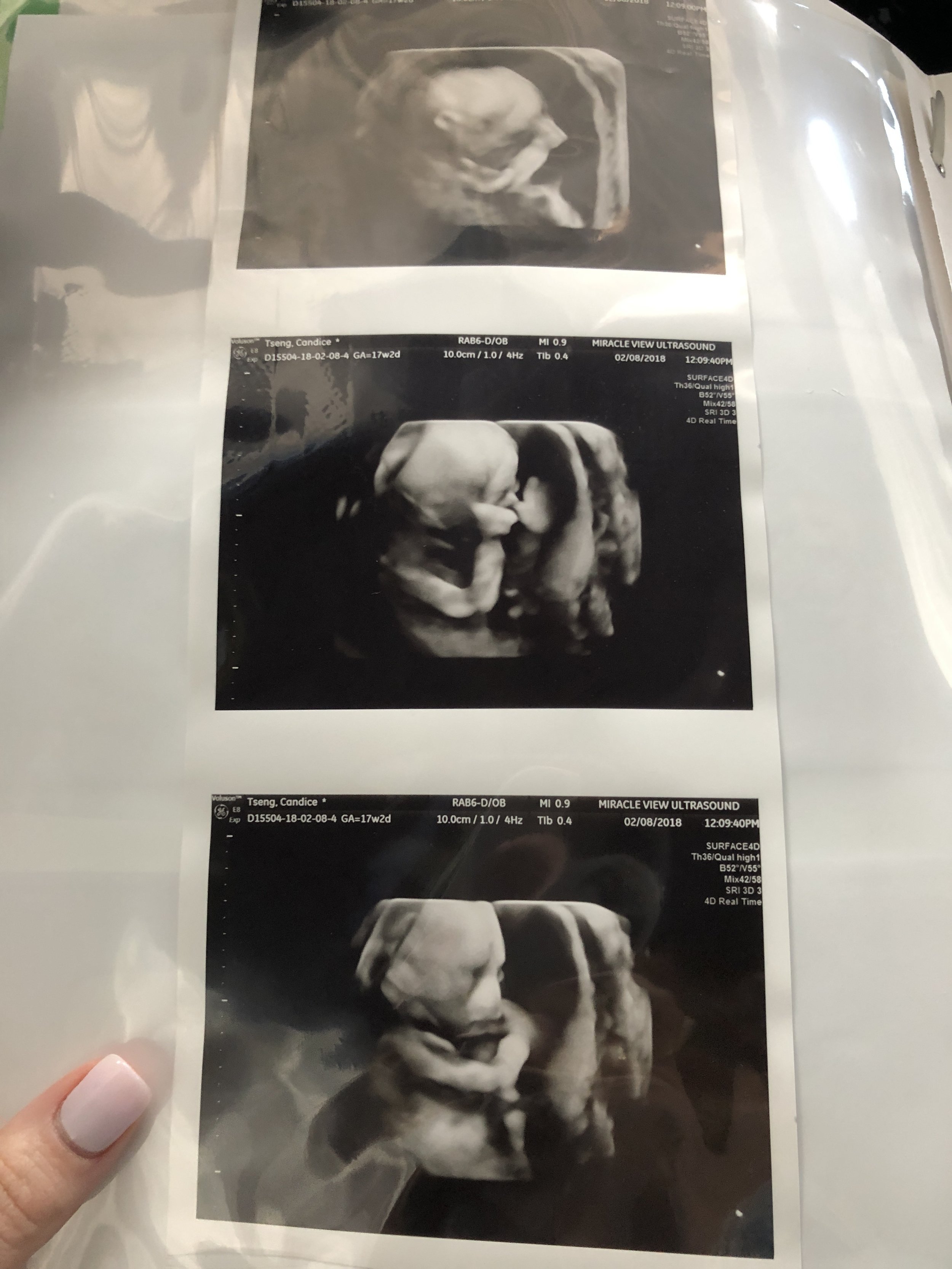 Boy or Girl? REVEALED!