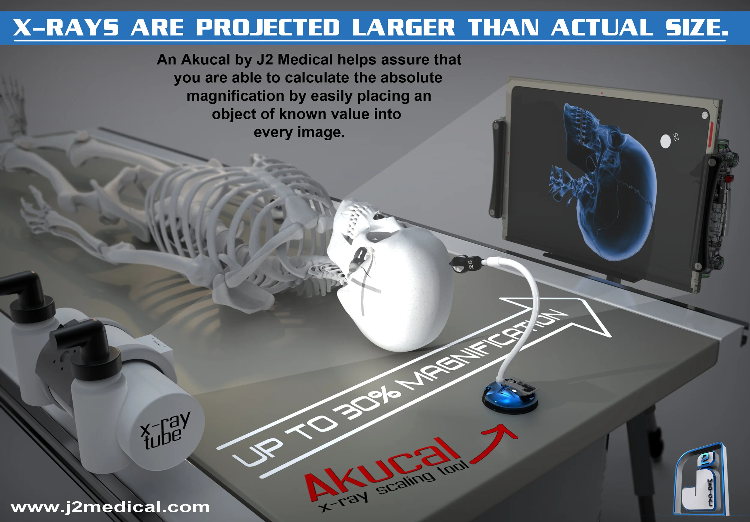 An Akucal by J2 Medical helps assure that you are able to calculate the absolute magnification by easily placing an object of known value into every image.