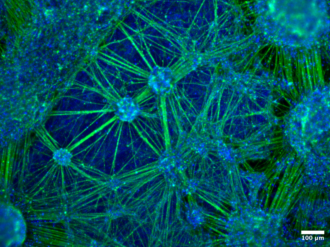 032225_D24iNeurons.lif - B3_10x_003_Processed001_higherDAPI.png