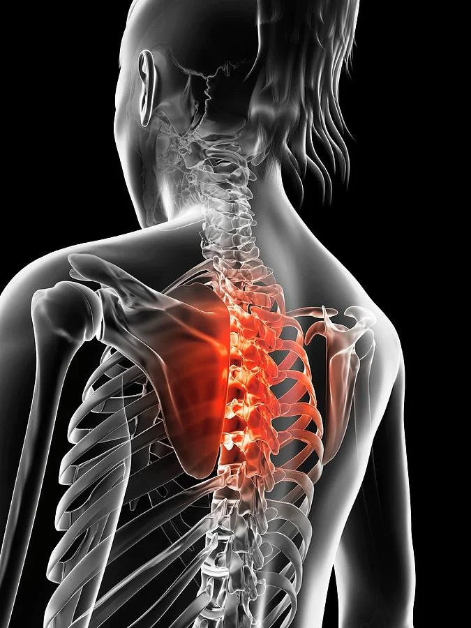 image back pain 3.jpg