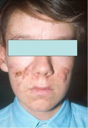 aCNE_8_300_433_70.jpg
