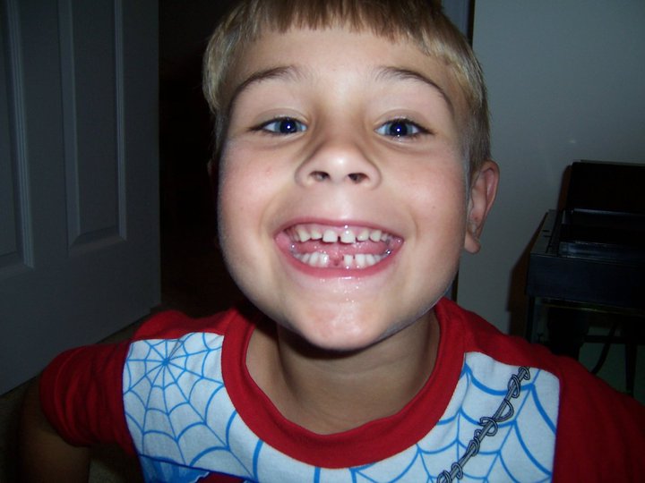 2010 E's first tooth.jpeg