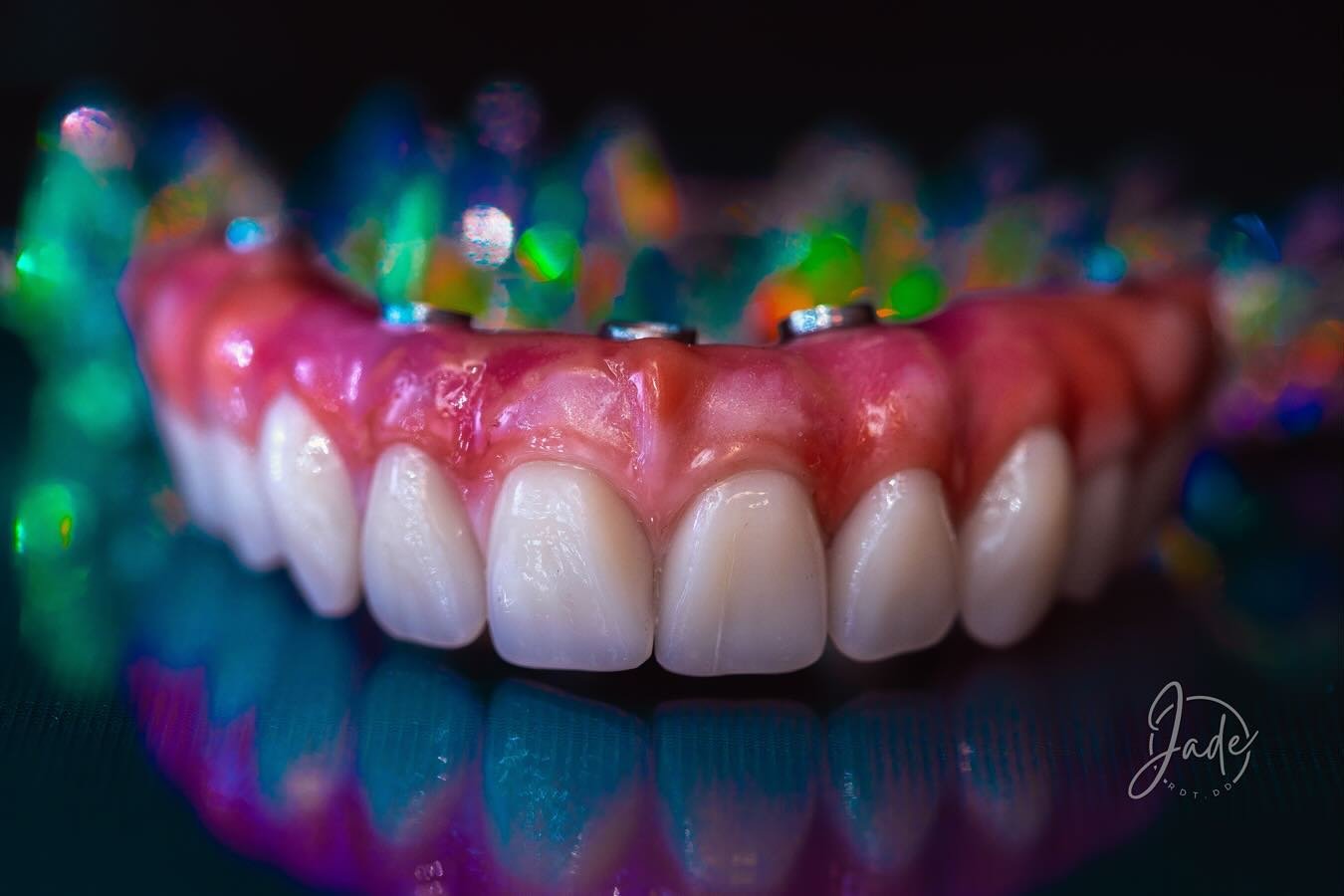 The sparks of light and colour ✨🌈.
.
.
.
Teeth + Wax: @candulor 
Photo + Maker: @jade.rdtdd 
Bar: @nobelbiocareus
.
.
.
#denture #denturetechnician #dentalphotographers #candulor #nobelbiocare #denturist #denturistlife #clinicaldentaltechnician #imp