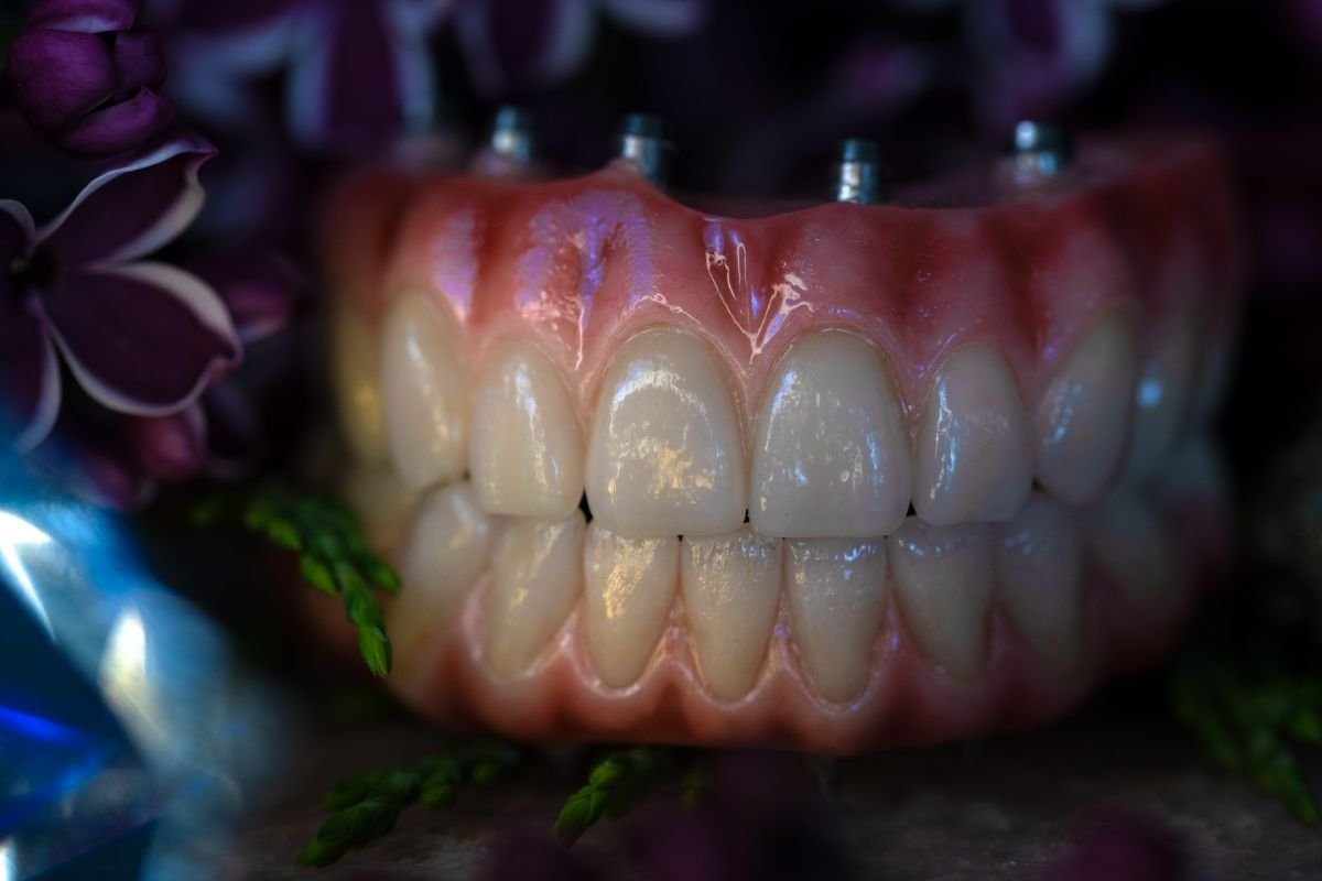 fixed-hybrid-dentures-04.jpg