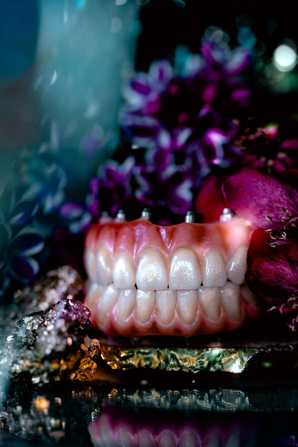 fixed-hybrid-dentures-05.jpg