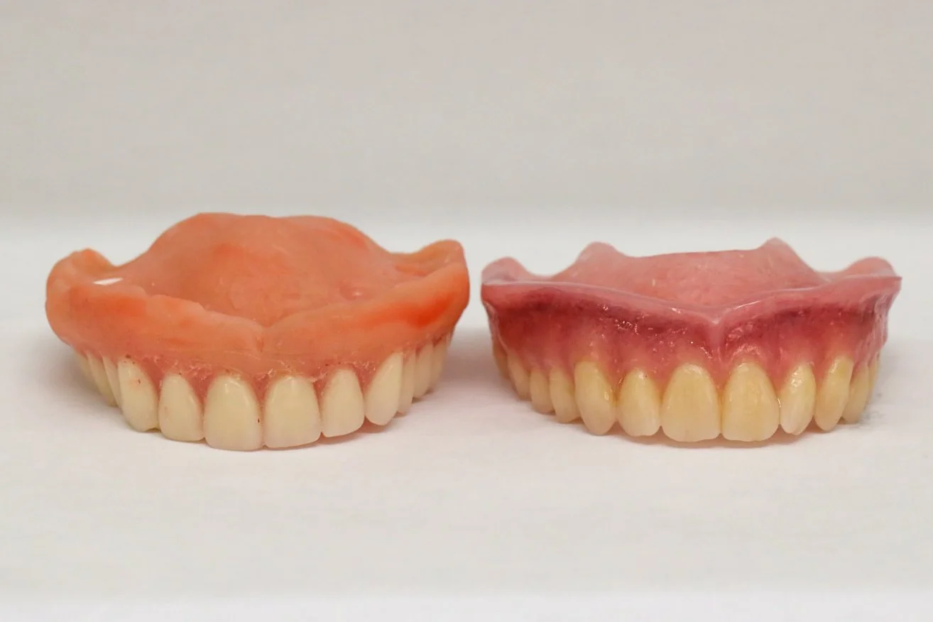 Old Denture Versus New Denture
