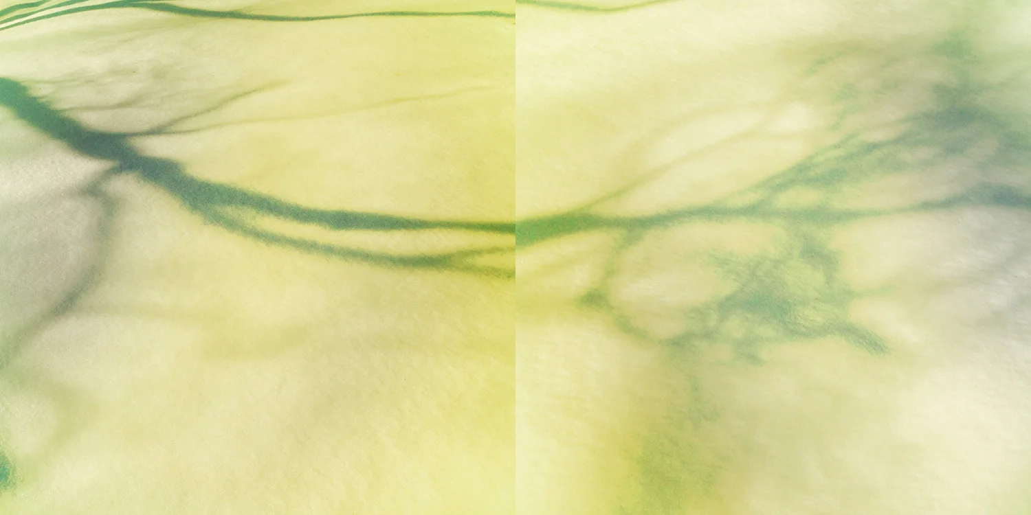 tree shadows on snow.jpg