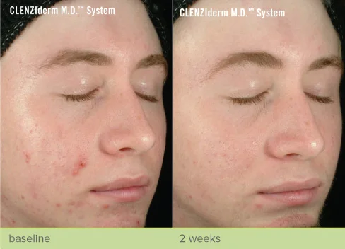 obagi nu derm precio