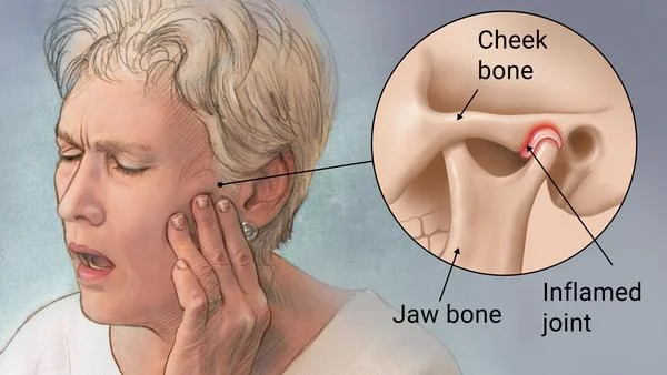 TMJ symptoms and treatments