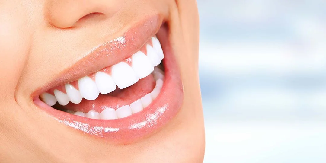Cosmetic Dentistry, Teeth Whitening, Veneer, Crowns and Dental Implants