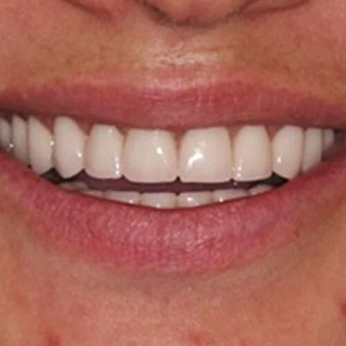 Orthodontics-pain-free-dentist-Dulwich-hill-dental-sydney-2.jpg