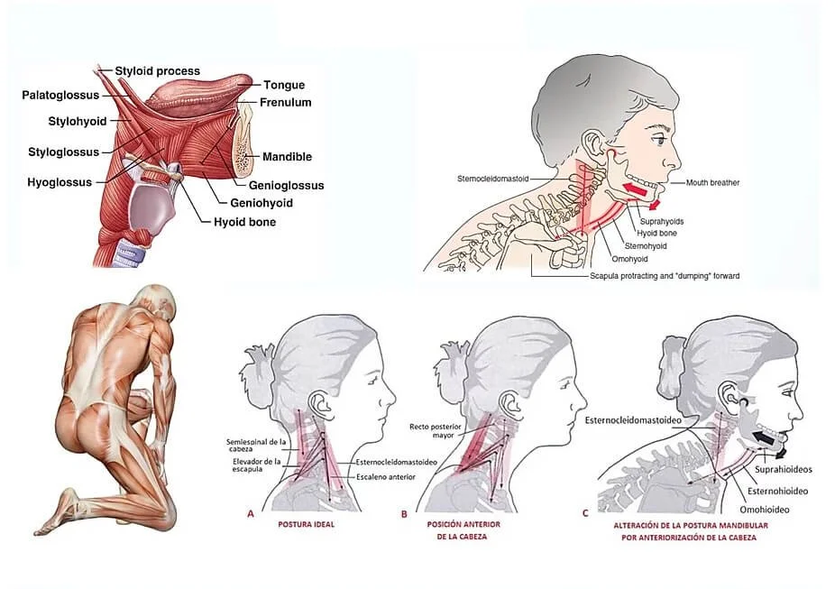 TMJ and Tongue Tie: How They're Connected and How We Can Help