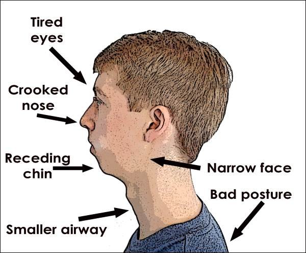 The Relationship Between Posture and Holistic Health