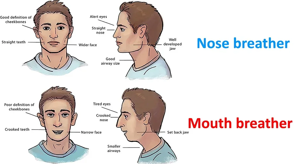 Mouth Breathing: How It Impacts Health and Wellbeing