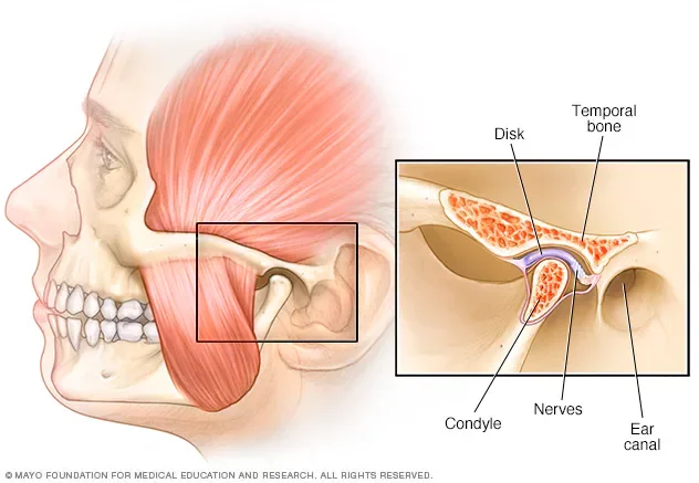 TMJ Disorder: Why Prompt Treatment Is Essential