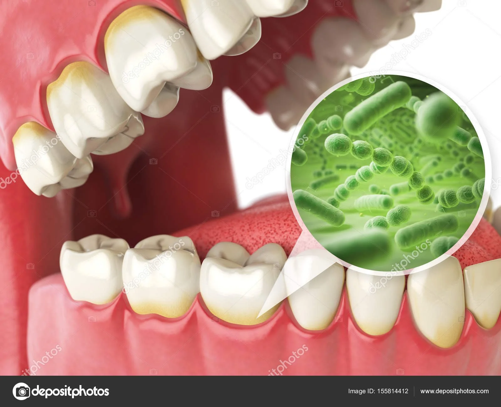 Gum Disease: Causes, Symptoms, Treatment & Prevention