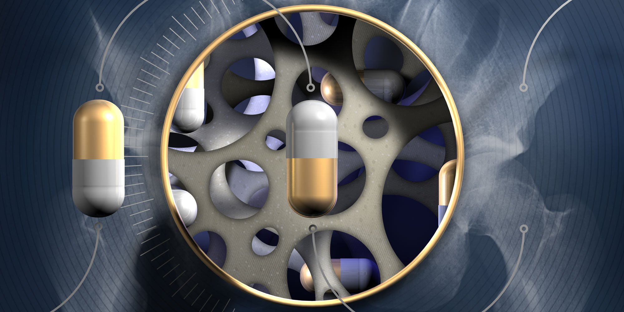 🦷 Pre-Check on Your Dental Condition Before Going on Bisphosphonates