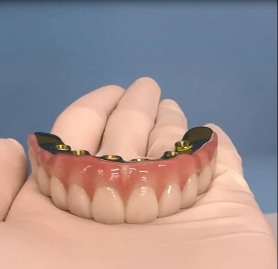 Dental Implants vs Dentures: A Long-Term Solution for Comfort and Quality of Life