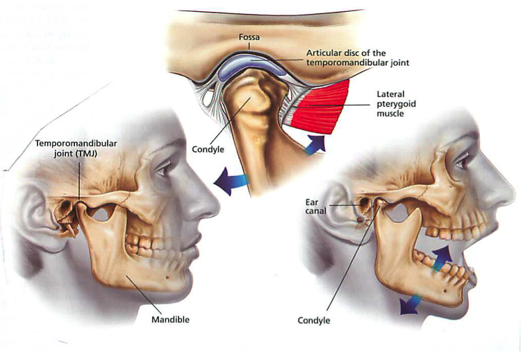 Botox for TMJ Relief: A Simple Guide to Jaw Pain Treatment