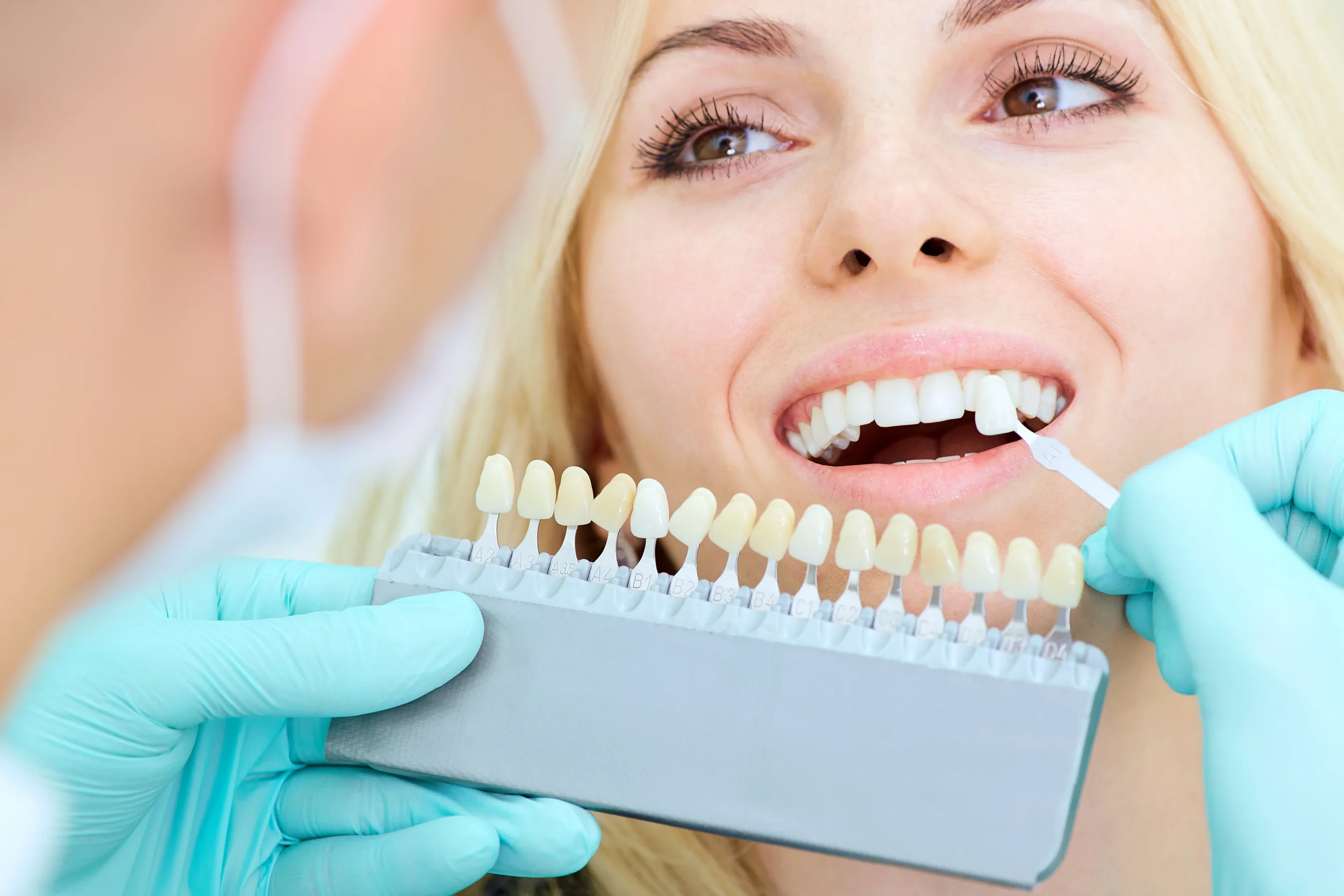 Achieving a Brighter Smile Safely: Professional Teeth Whitening at Pain Free Dentist Sydney