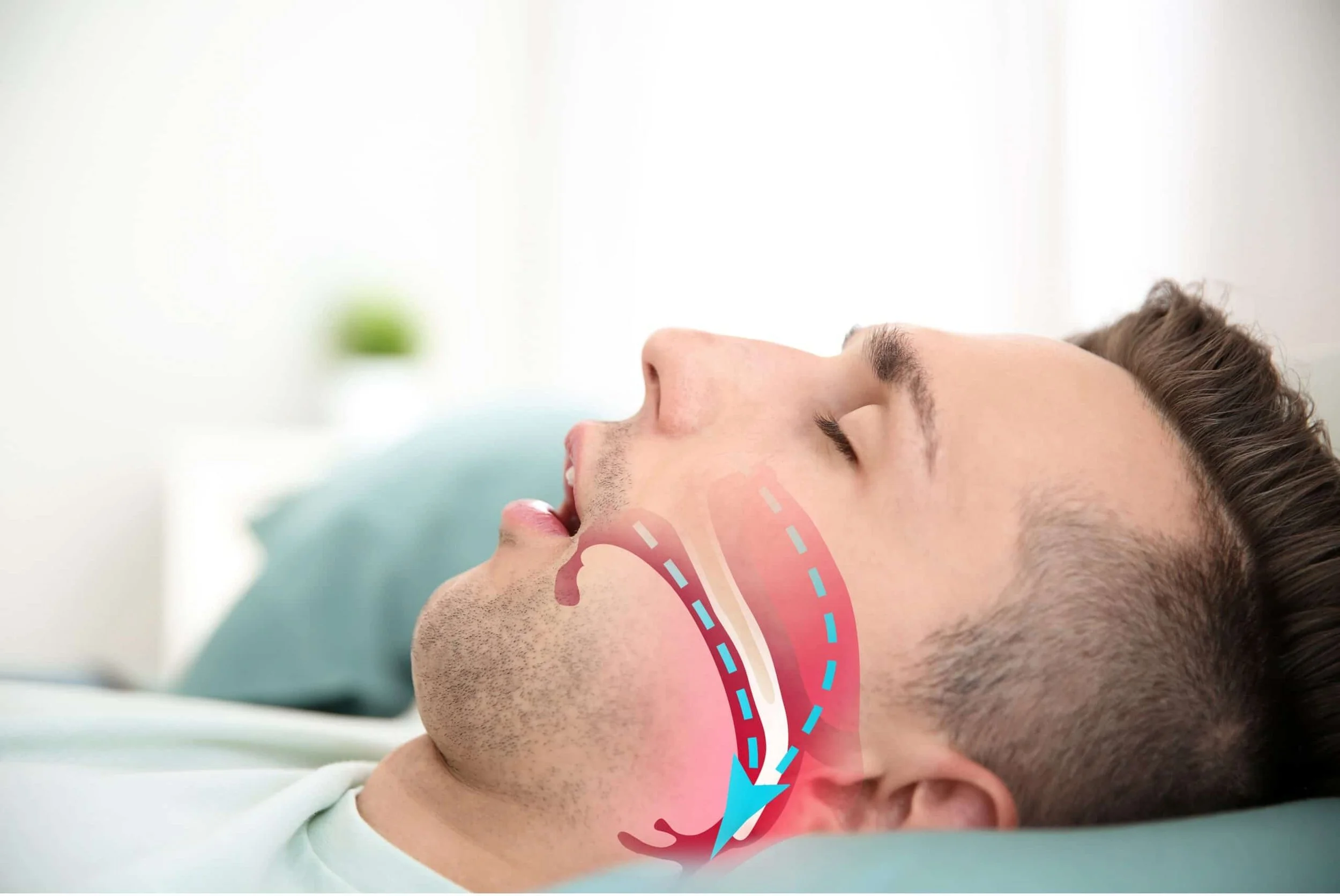 How Can I Stop Snoring? Can a Dentist Help?