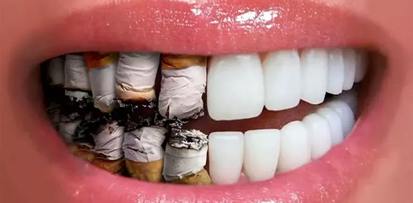 Smoking and Gum Health: The Hidden Toll on Your Smile