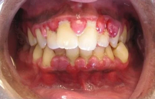 Wait… Am I Brushing Wrong? The One Mistake Almost Everyone Makes