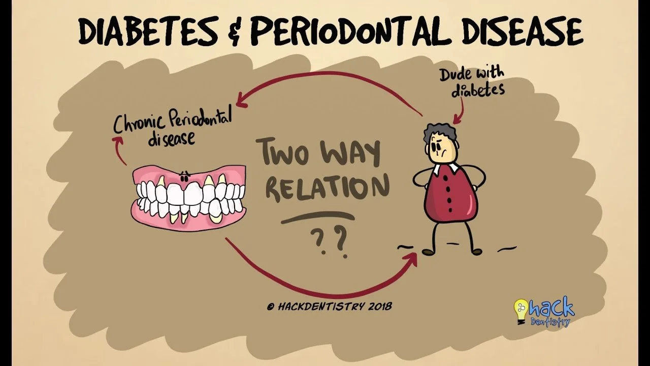 The Diabetes-Dentist Connection: Why Your Dentist Might Know Before Your Doctor
