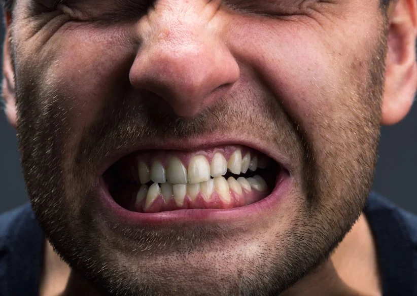 Can Stress Really Cause Teeth Grinding and Jaw Pain?