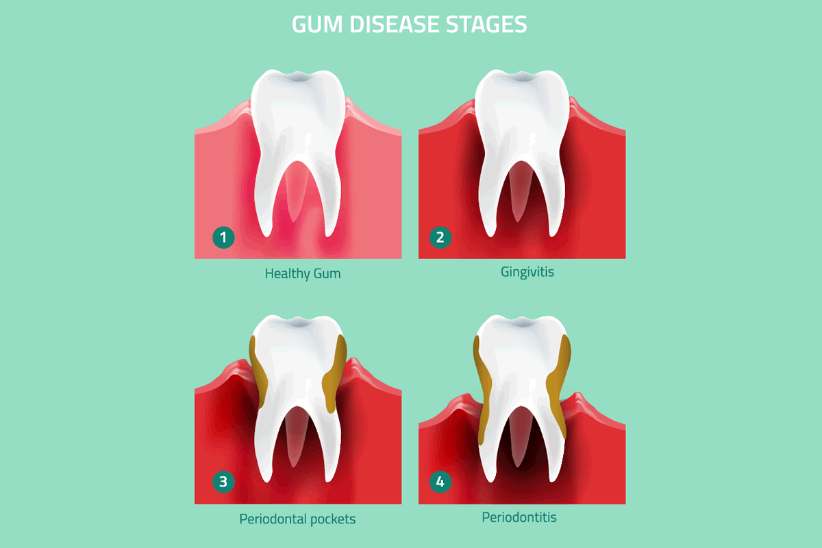 Pregnancy and Dental Health – What Every Mom-to-Be Should Know