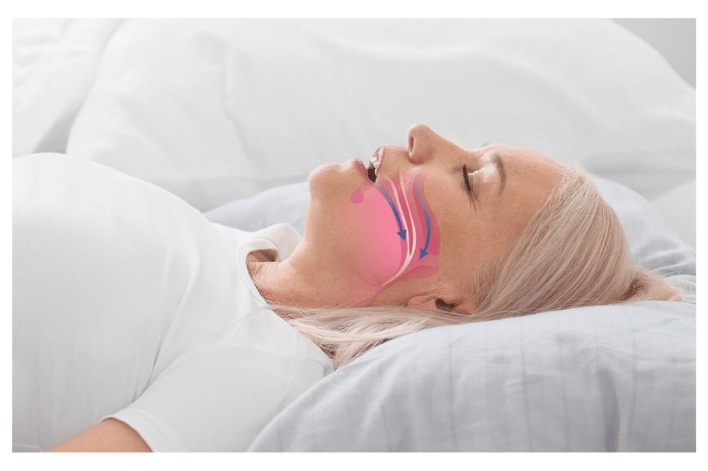 Sleep Apnea and TMJ Problems: Jaw Pain &amp; Sleep Health