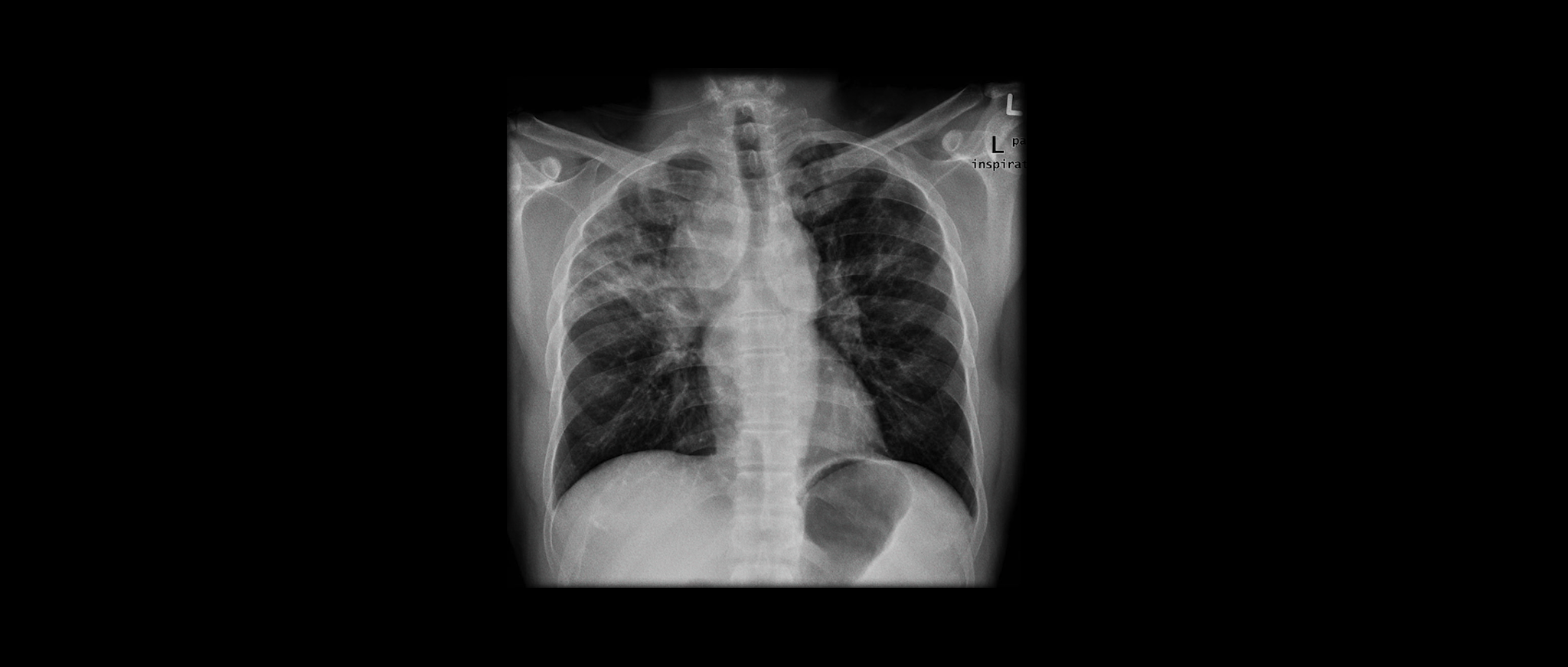 XRAY.png