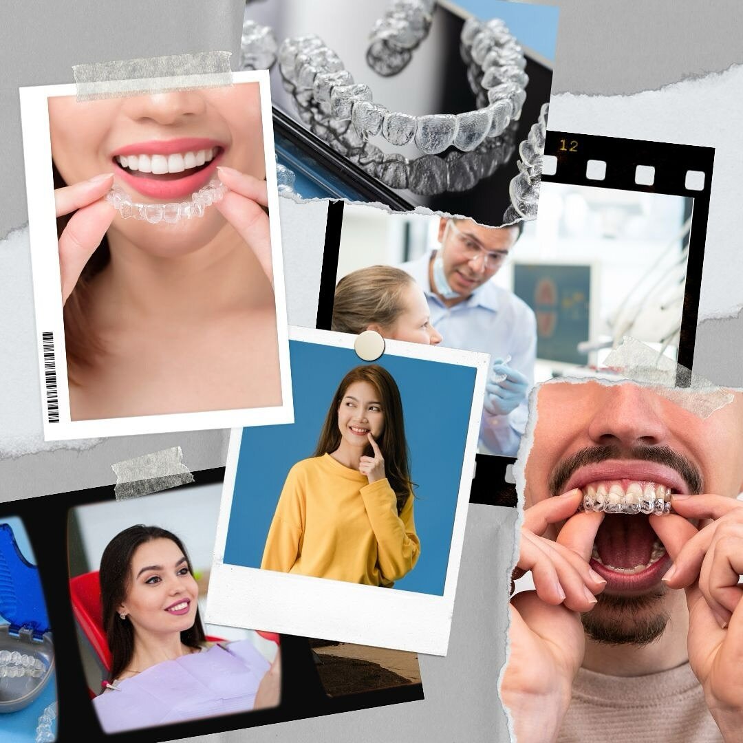 🌸 SPRING MOOD BOARD 🌸 

This Spring, Invisalign is IN! And for you to improve your smile while saving big, we are offering $2000 OFF of your Invisalign treatment! Call now to schedule! 

#spring #smile #moodboard #championorthodontics #raleigh #wak