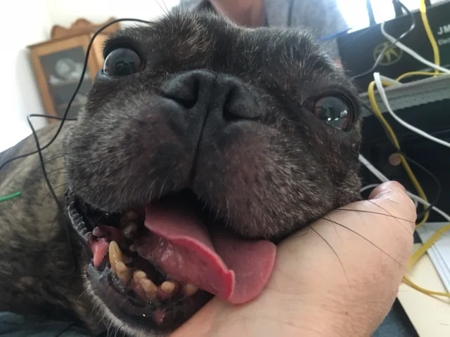 Zoe is getting acupuncture for a neck injury. You can see she really gets into her treatments!