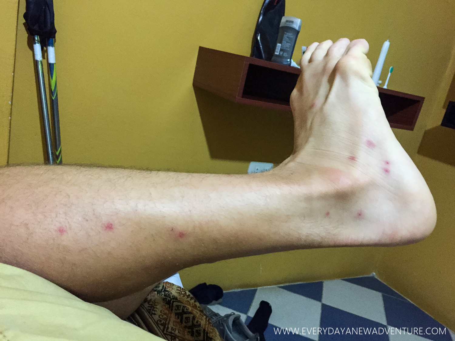 The mosquitos were ruthless!