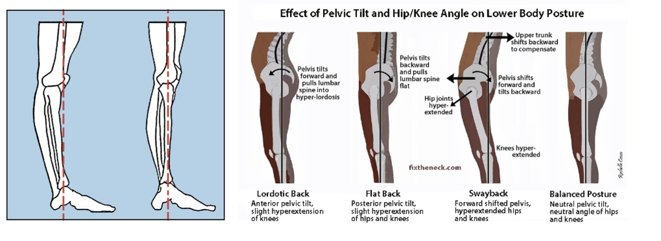 What Muscles Helps Prevent Knee Hyperextension? : What Muscles Does