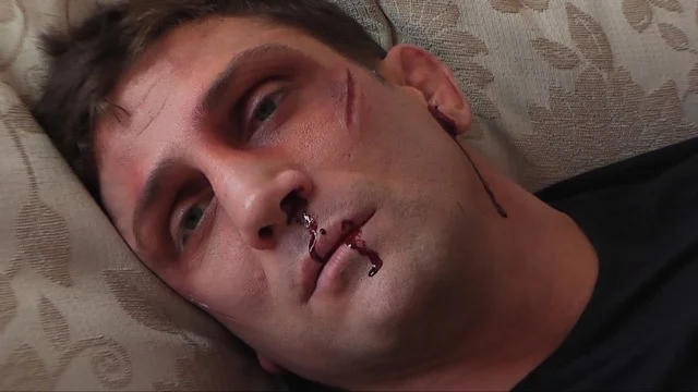 'The Fighter' Alex Reid Director: Philip Carr Writer: Ryan Enever Makeup: Sarah Shaw