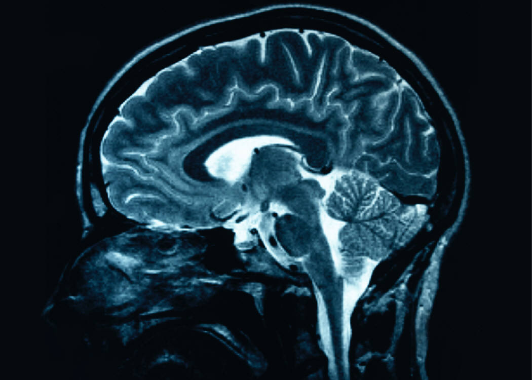 Reaching the Mentally Ill Millions