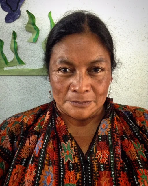 Solola Patient after treatment.