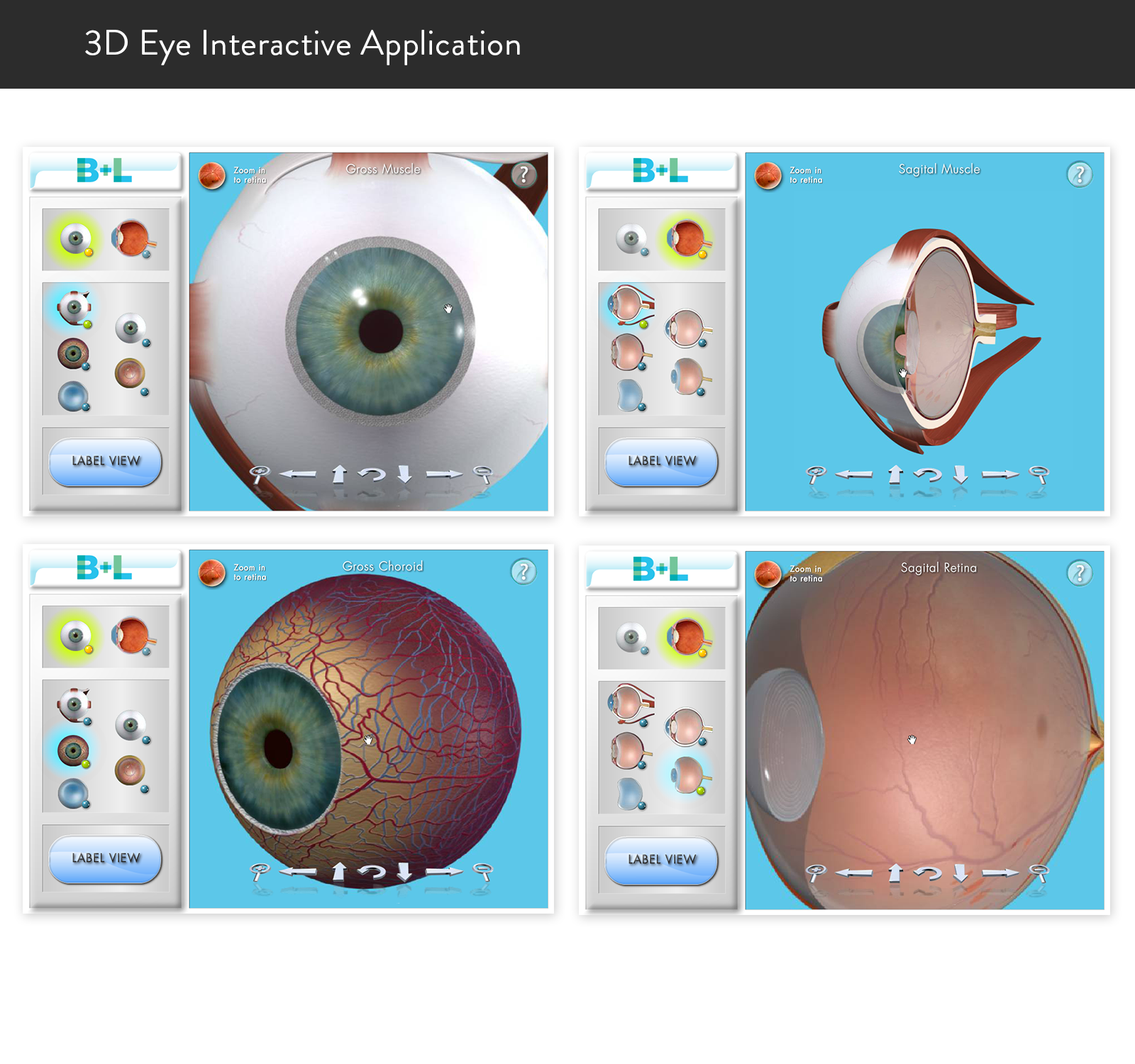 Case_Template_Bausch_03.png